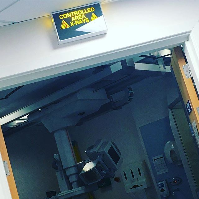 Great start to 2018 😫 Broke my big toe removing furniture from my dad’s house. Can I just say that the pain of dropping a coffee table on my foot was WAY worse than childbirth. Seriously 😱. I’ve spent the day in A&E where they drained it - yep, it was as gross & painful as it sounds so now I’m trying to rest and recover. It’s not exactly how I’d planned starting the new year but at least I have a legit excuse to lie on the sofa & binge watch #TheCrown, every cloud and all that! 🙌 #brokentoe Big shoutout to @jrsiddle who is now mum & dad whilst I’m out of action ❤️